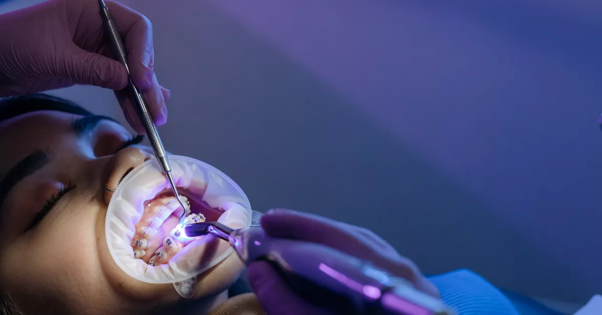 ClearChoice Dental Implants Cost